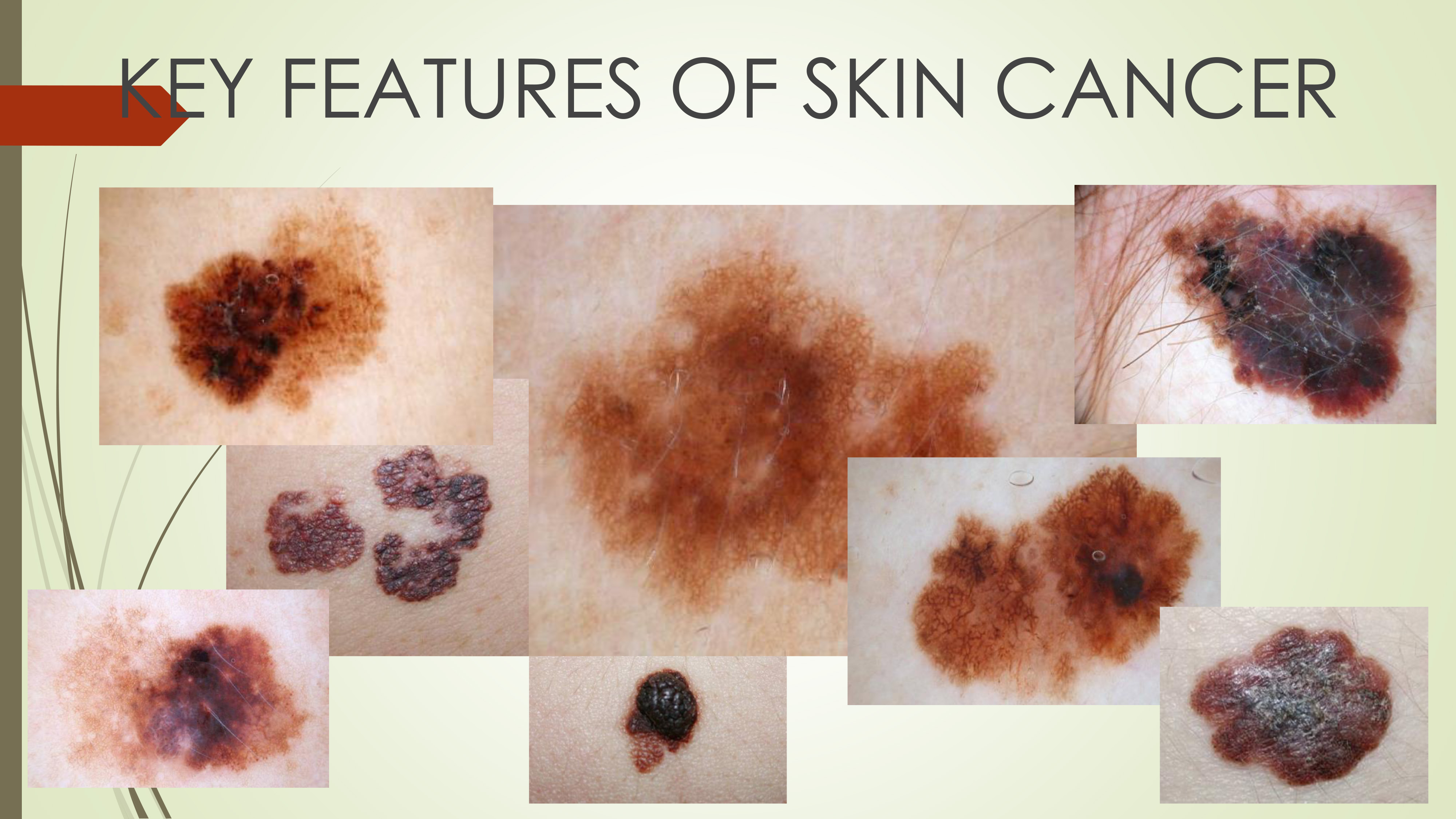 Identification of skin oncological diseases AI